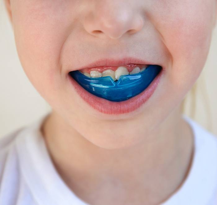 young girl wearing a protective mouthguard 