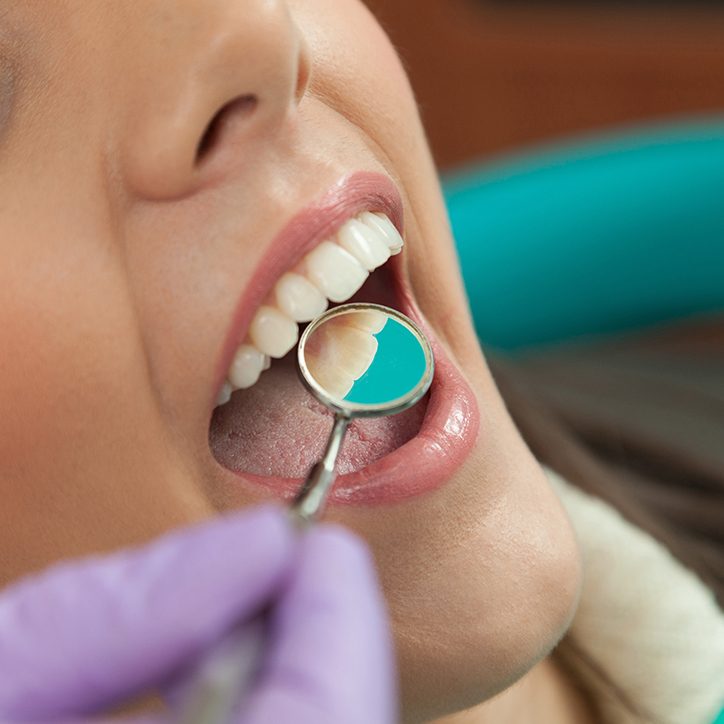 Dentist checking patient's metal free dental restoration