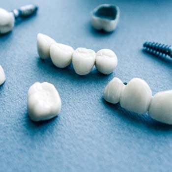 Different types of dental implants in Long Beach on blue background