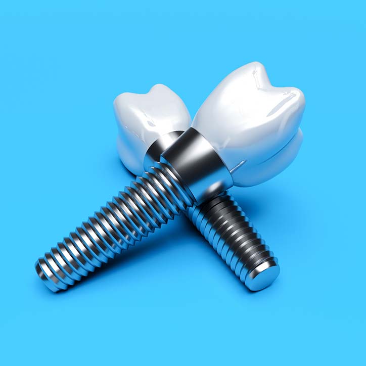 Closeup of dental implants in Long Beach on blue background