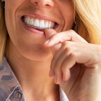 Closeup of woman putting on clear aligner