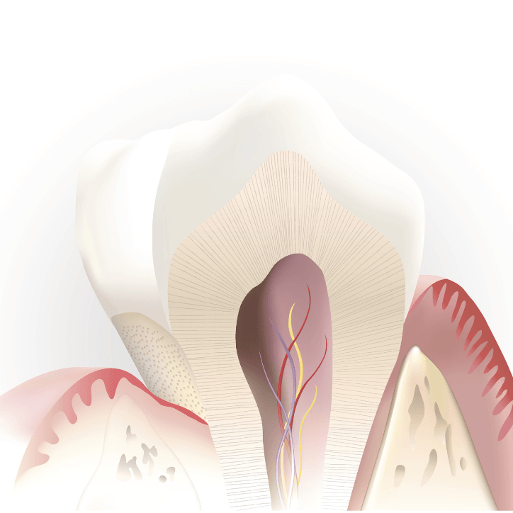Animated inside of tooth before pulp therapy