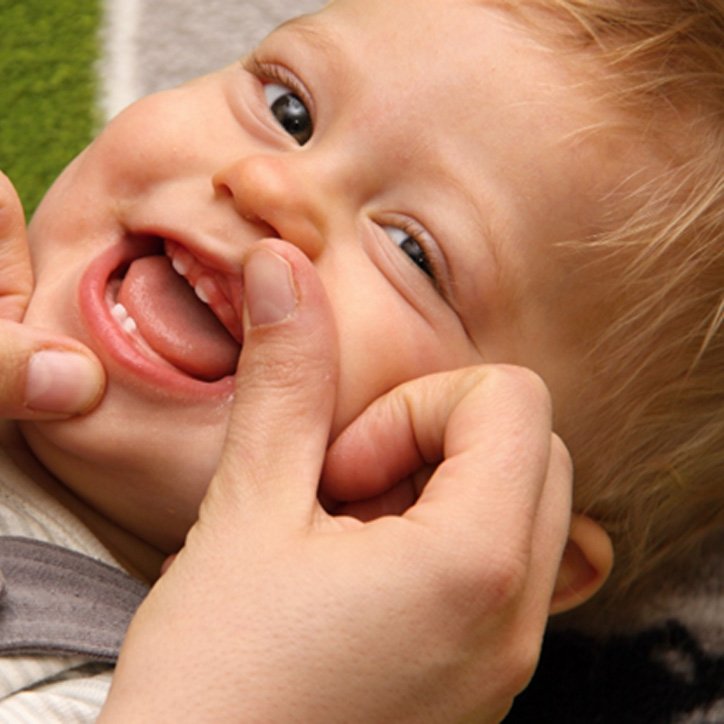 a smiling baby that needs to have a lip or tongue-tie in Long Beach treated